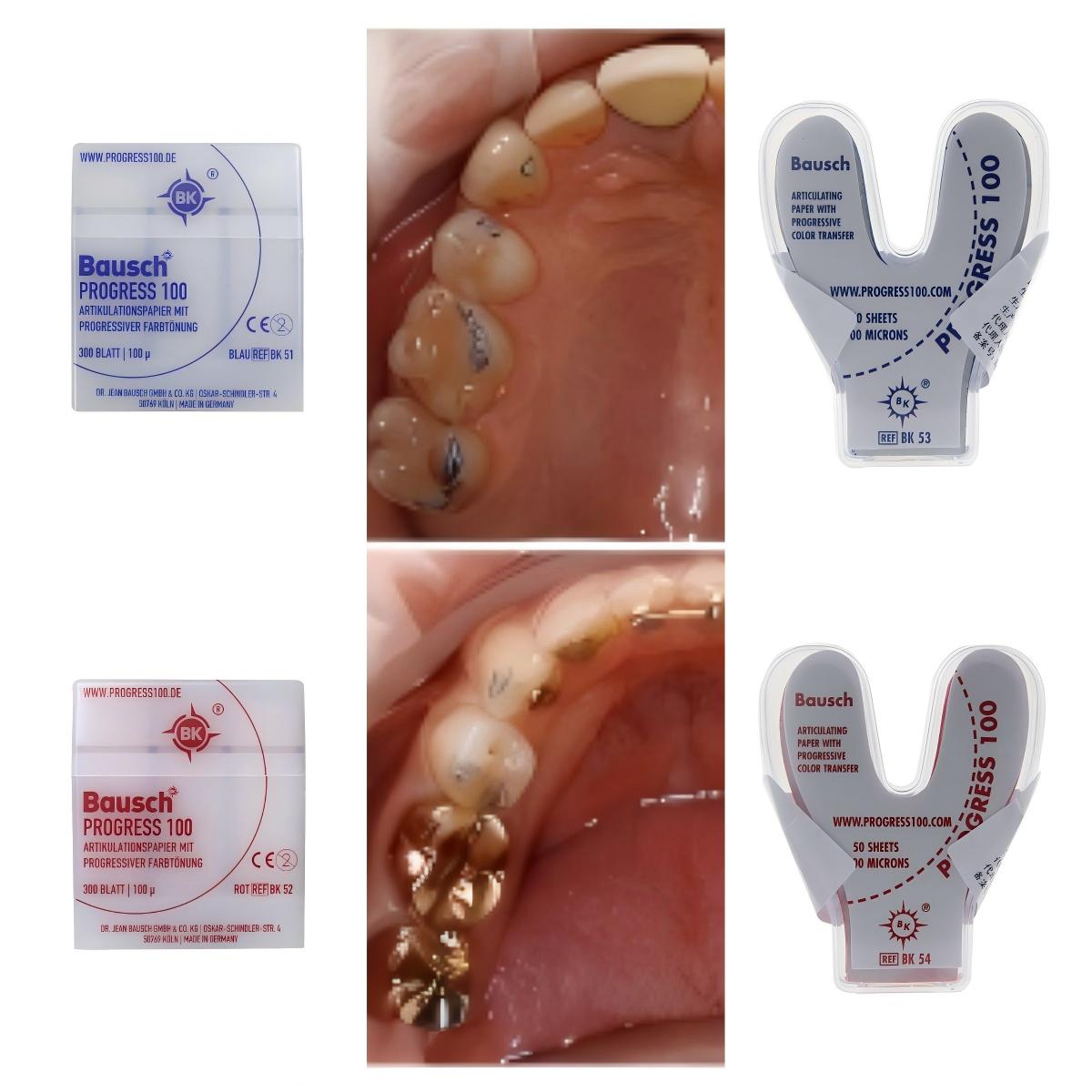 Papier artikulacyjny dentystyc – Bite Indicator recenzja i cena